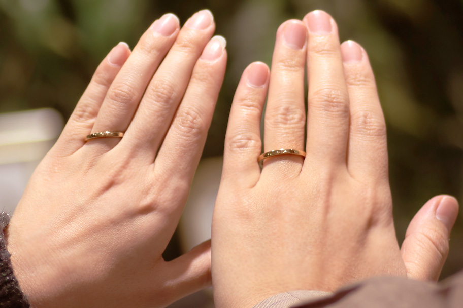 金属アレルギー対応の結婚指輪選び なりにくいおすすめ素材と後悔しないポイント