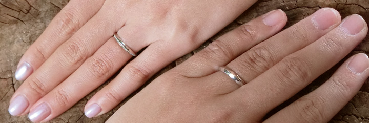 金属アレルギーと結婚指輪選びにおける よくある疑問と対処法